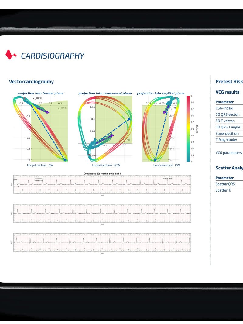 Cardisiographie-Auswertung auf dem Tablet